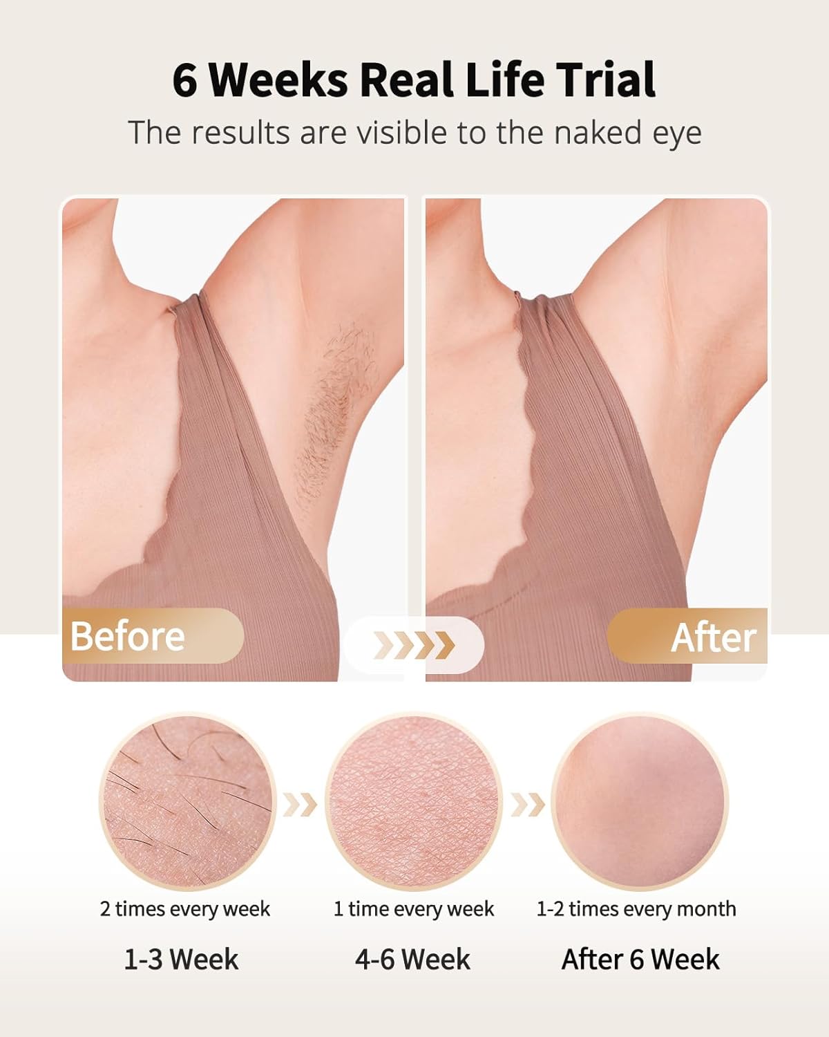 Laser Hair Removal with Ice Co - огляд і ціна Hair Care Or Haircare