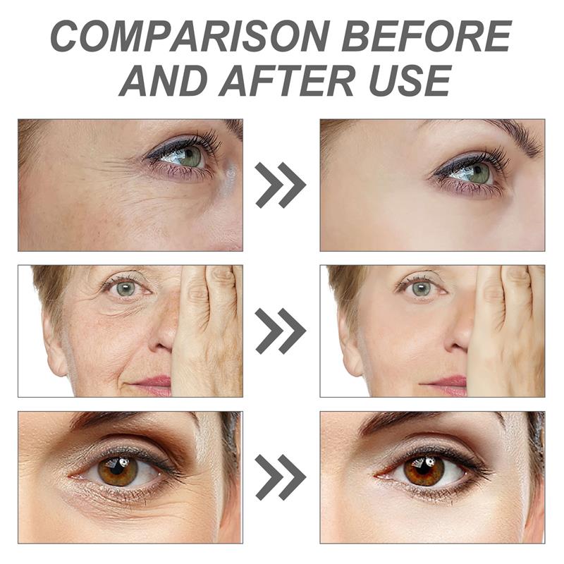 Retinol Remove Wrinkle Face Se - огляд і ціна The Ordinary Serum Hyaluronic Acid
