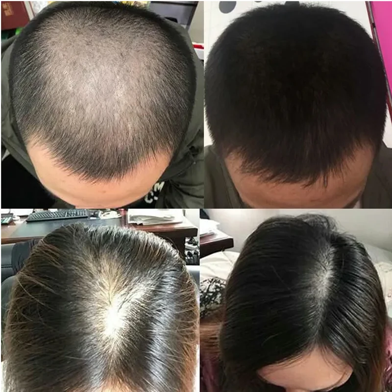 Overlord Plant Hair Growth Liq - огляд і ціна Hair Care Or Haircare