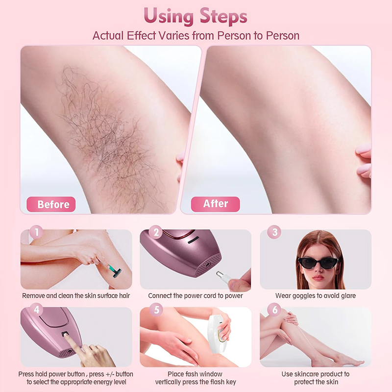 IPL laser Hair Remover Hair Cu - огляд і ціна Hair Care Or Haircare